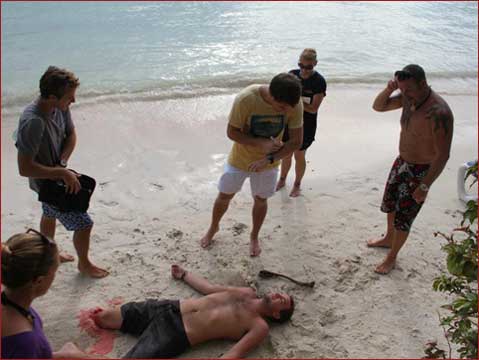 MIRA and FPOS-I: Traumatic Amputation Scenario