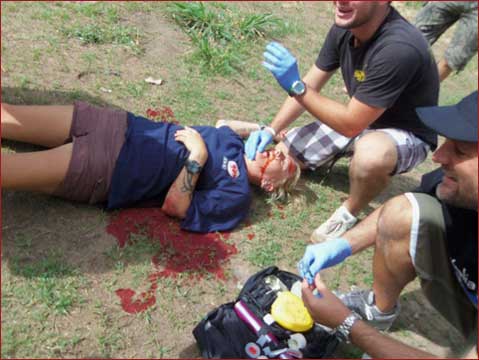 MIRA and FPOS-I: Gun Shot Wound Scenario