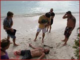 FPOS-I Traumatic Amputation Scenario on the Beach